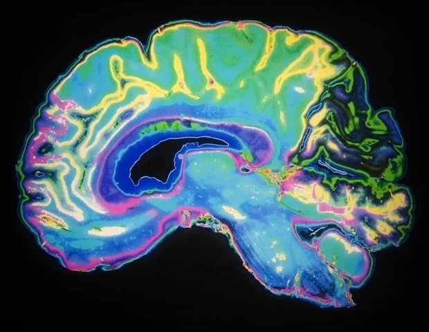 Ilustrasi gelombang otak dan pemantauan aktivitas neural sebelum stimulasi