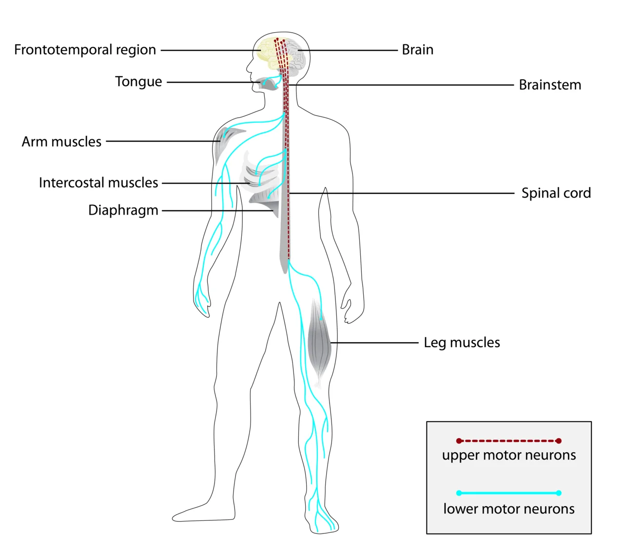 Ilustrasi pemeriksaan medis terkait kondisi gangguan saraf motorik amyotrophic lateral sclerosis