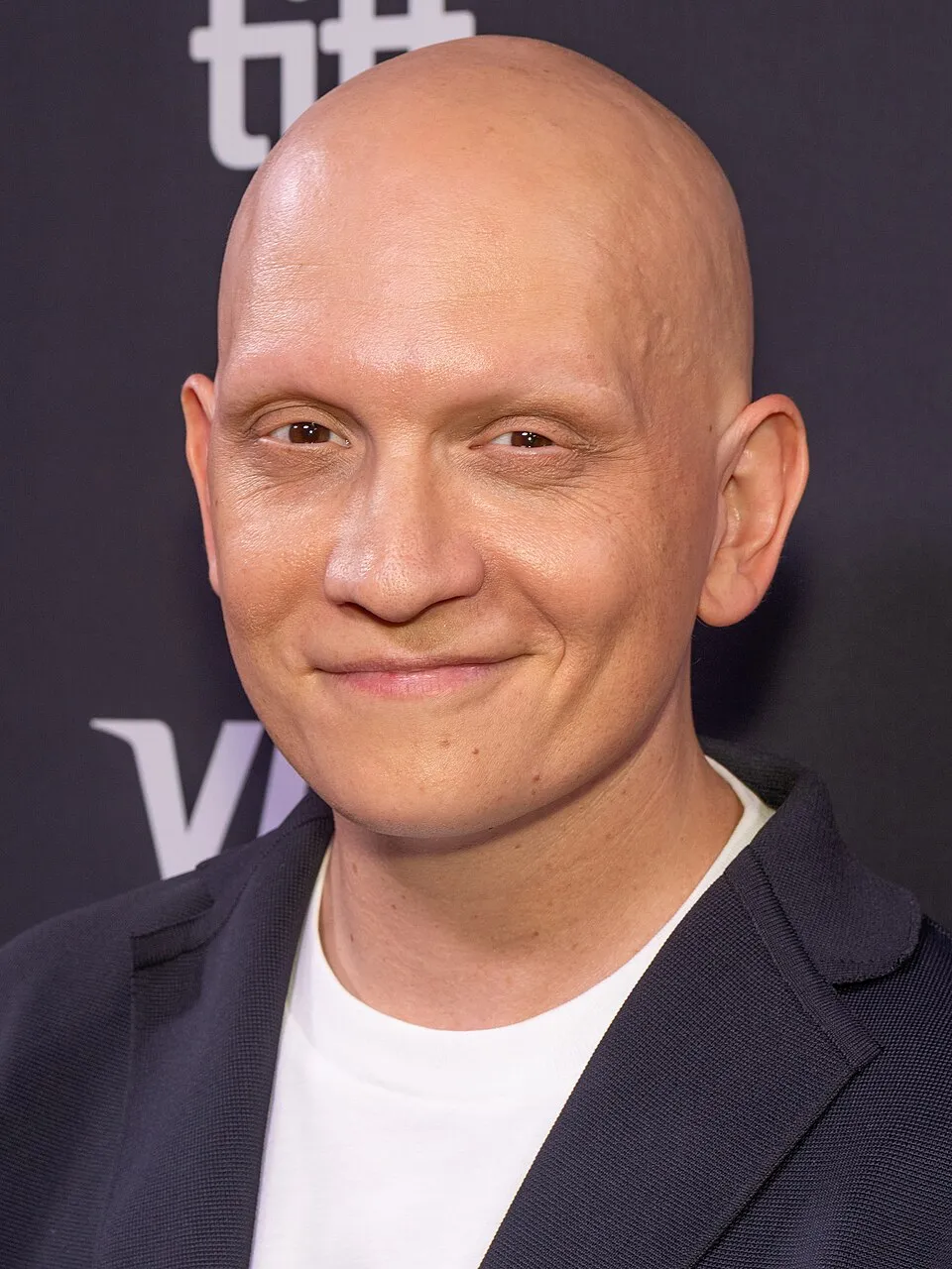 Aktor Amerika Anthony Carrigan yang dikenal lewat serial Barry