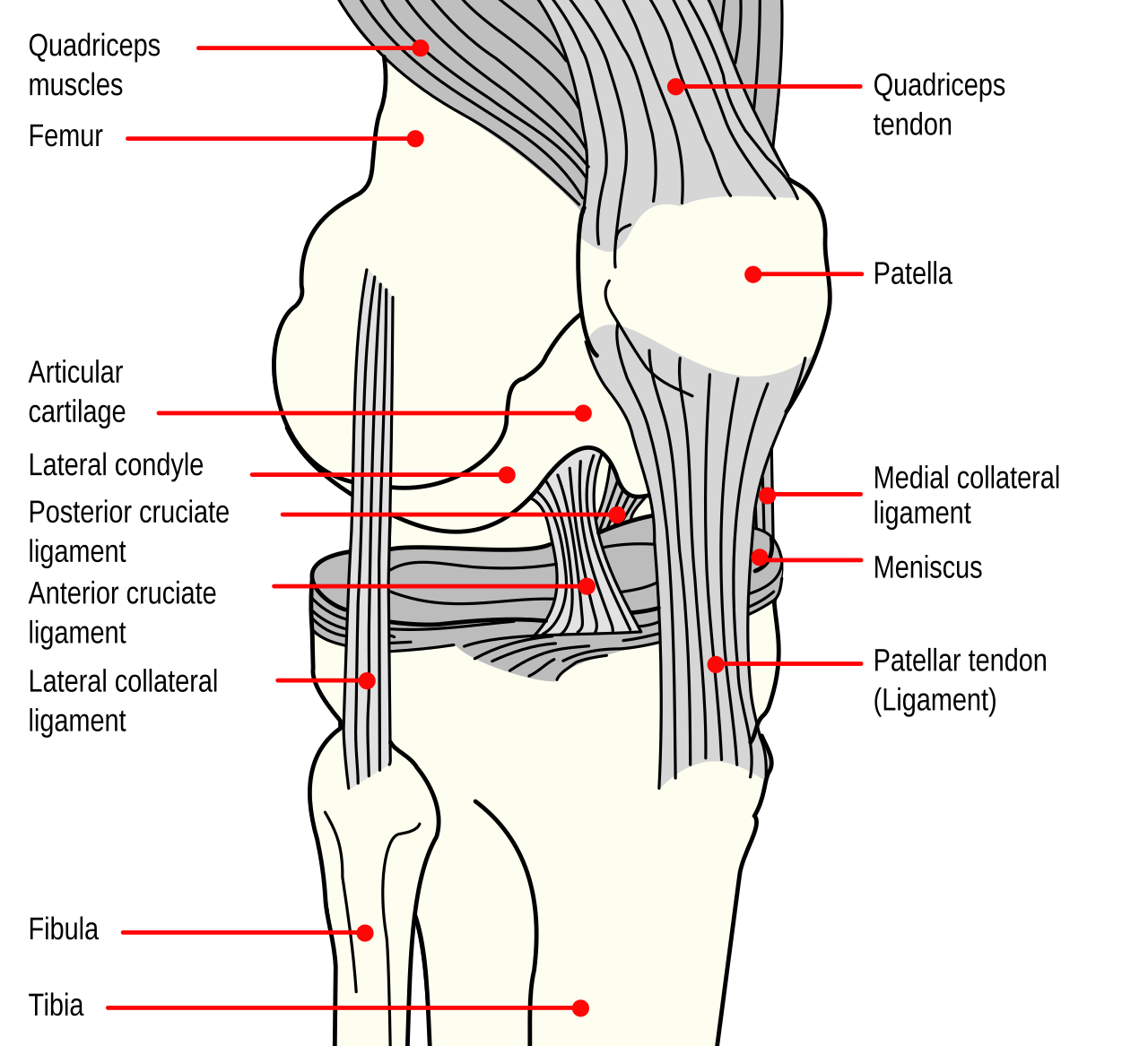 Ilustrasi anatomi sendi lutut manusia yang menunjukkan kondisi ligamen krusiata anterior