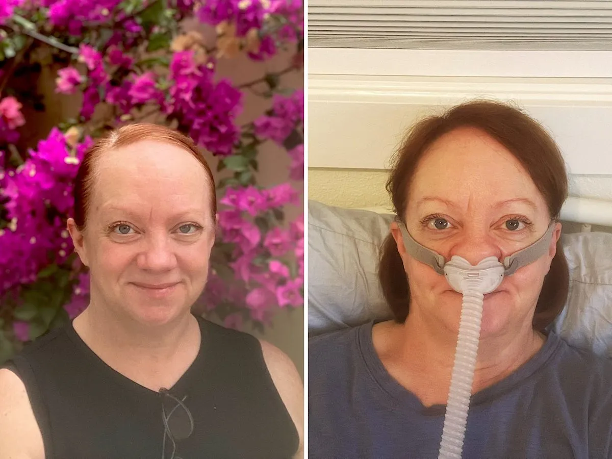 Ilustrasi wanita mengalami kelelahan kronis akibat gangguan tidur sleep apnea