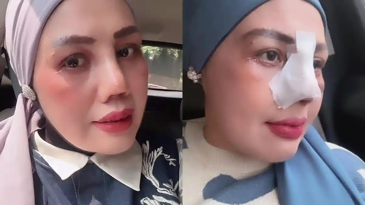 Potret terbaru komedian Elly Sugigi yang tampil percaya diri usai menjalani operasi plastik wajah